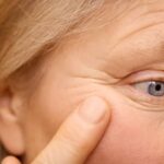 Botox Injections