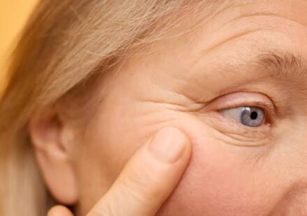 Botox Injections